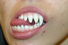 Dental_22