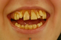 FX_T_Dental_ener_06_01