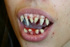 dental_08